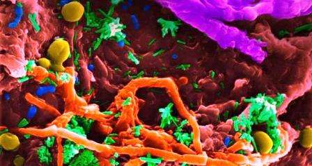 Колонии бактерий, живущих в Унитазе