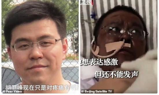 Китайские врачи почернели из-за коронавируса